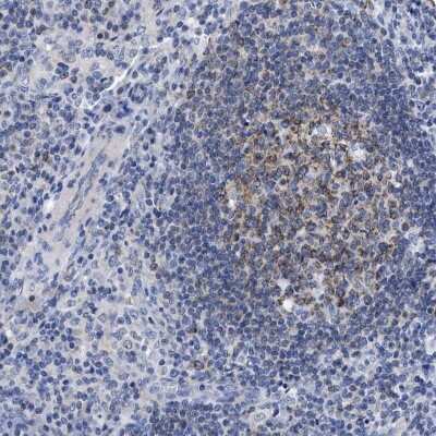 Immunohistochemistry-Paraffin: LRMP/Jaw1 Antibody [NBP1-87723]
