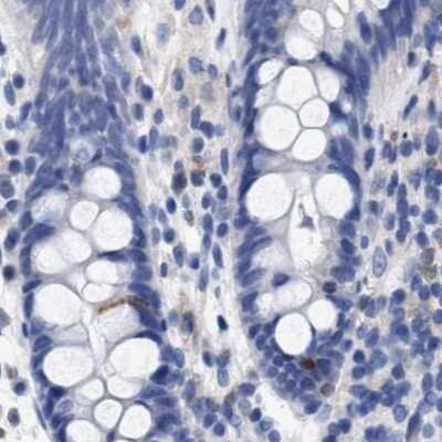 Immunohistochemistry-Paraffin: LRMP/Jaw1 Antibody [NBP1-87723]