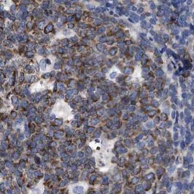 Immunohistochemistry-Paraffin: LRMP/Jaw1 Antibody [NBP1-87723]