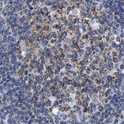 Immunohistochemistry-Paraffin: LRMP/Jaw1 Antibody [NBP1-87723]