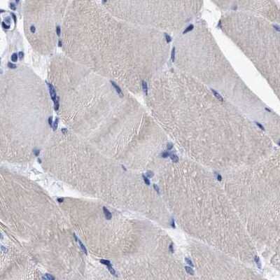 Immunohistochemistry-Paraffin: LRMP/Jaw1 Antibody [NBP1-87723]