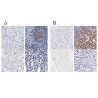 Immunohistochemistry-Paraffin: LRMP/Jaw1 Antibody [NBP1-87723]