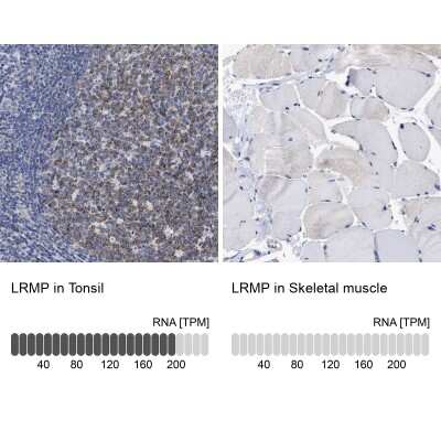 Immunohistochemistry-Paraffin: LRMP/Jaw1 Antibody [NBP1-87723]