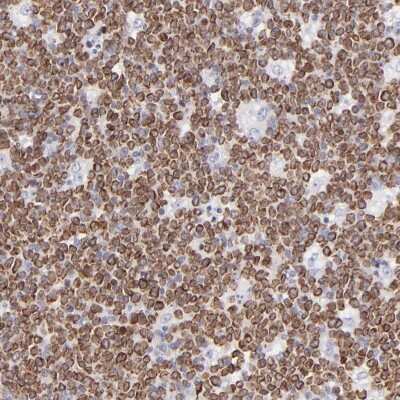 Immunohistochemistry-Paraffin: LRMP/Jaw1 Antibody [NBP1-87724]