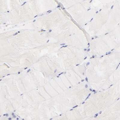 Immunohistochemistry-Paraffin: LRMP/Jaw1 Antibody [NBP1-87724]