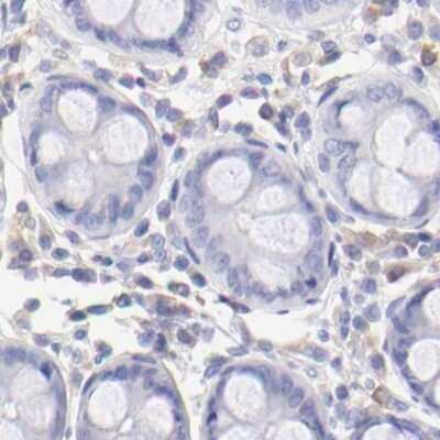 Immunohistochemistry-Paraffin: LRMP/Jaw1 Antibody [NBP1-87724]