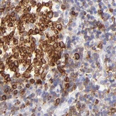 Immunohistochemistry-Paraffin: LRMP/Jaw1 Antibody [NBP1-87724]