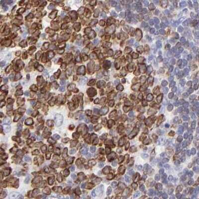 Immunohistochemistry-Paraffin: LRMP/Jaw1 Antibody [NBP1-87724]