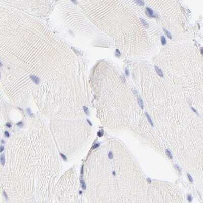 Immunohistochemistry-Paraffin: LRMP/Jaw1 Antibody [NBP1-87724]