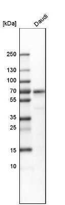 Western Blot: LRMP/Jaw1 Antibody [NBP1-87724]