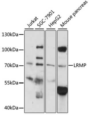 Western Blot: LRMP/Jaw1 AntibodyAzide and BSA Free [NBP3-03425]