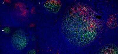 Immunofluorescence: LRP-1 Antibody (A2Mr alpha-2) - BSA Free [NB100-64808]