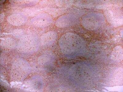 Immunohistochemistry: LRP-1 Antibody (A2Mr alpha-2) - BSA Free [NB100-64808]