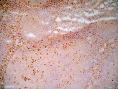 Immunohistochemistry: LRP-1 Antibody (A2Mr alpha-2) - BSA Free [NB100-64808]