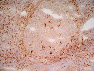 Immunohistochemistry: LRP-1 Antibody (A2Mr alpha-2) - BSA Free [NB100-64808]