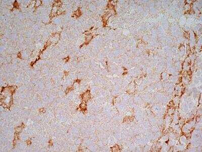 Immunohistochemistry: LRP-1 Antibody (A2Mr alpha-2) - BSA Free [NB100-64808]