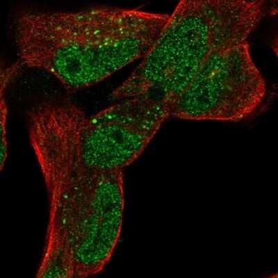 Immunocytochemistry/ Immunofluorescence: LRP-1 Antibody [NBP2-48497]