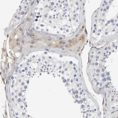 Immunohistochemistry-Paraffin: LRP-1 Antibody [NBP2-48497]