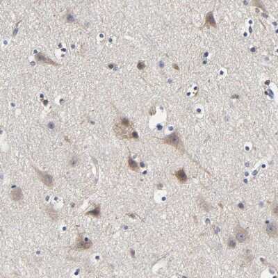 Immunohistochemistry-Paraffin: LRP-1 Antibody [NBP2-48497]