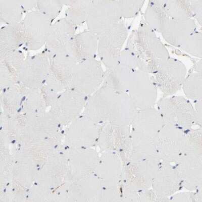 Immunohistochemistry-Paraffin: LRP-1 Antibody [NBP2-48497]