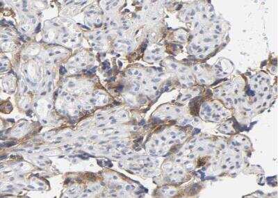 Immunohistochemistry-Paraffin: LRP-1 Antibody [NBP2-48497]