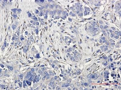 Immunohistochemistry-Paraffin: LRP-1 Antibody (S09-4E8) [NBP3-19934]