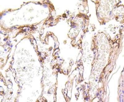 Immunohistochemistry-Paraffin: LRP-1 Antibody (SA0290) [NBP2-67286]