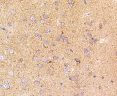 Immunohistochemistry-Paraffin: LRP-1 Antibody (SA0290) [NBP2-67286]