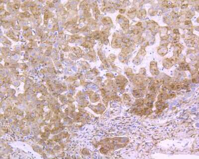 Immunohistochemistry-Paraffin: LRP-1 Antibody (SA0290) [NBP2-67286]