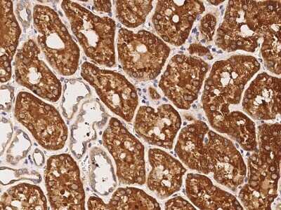 Immunohistochemistry: LRP-11 Antibody [NBP3-00238]