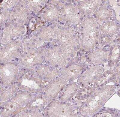 Immunohistochemistry-Paraffin: LRP-1B Antibody [NBP2-49582]