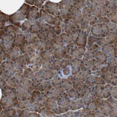 Immunohistochemistry-Paraffin: LRP-4 Antibody [NBP1-81240]