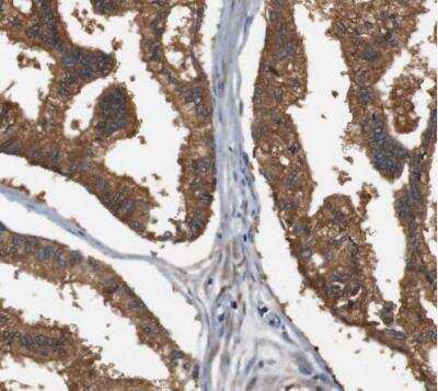 Immunohistochemistry-Paraffin: LRP-4 Antibody [NBP1-81241]