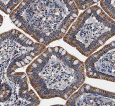Immunohistochemistry-Paraffin: LRP-4 Antibody [NBP1-81241]