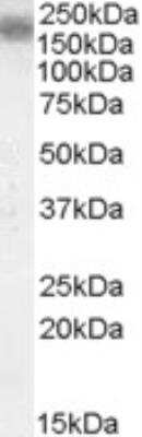 Western Blot: LRP-4 Antibody [NBP1-28482]