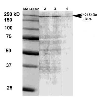 Western Blot: LRP-4 Antibody (S207-27) [NBP2-22416]