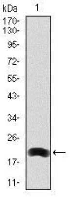 Western Blot: LRP-5 Antibody (2B11)BSA Free [NBP2-37510]