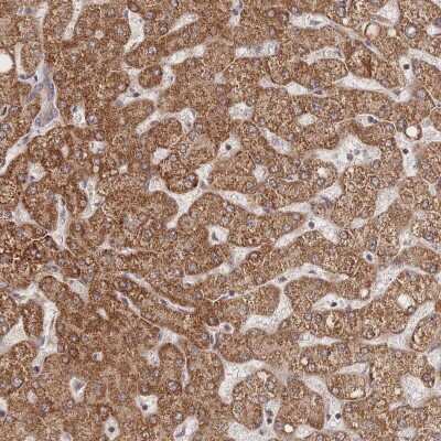 Immunohistochemistry-Paraffin: LRP-5 Antibody [NBP2-37868]