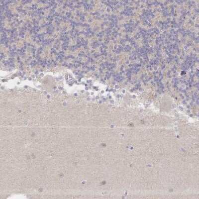 Immunohistochemistry-Paraffin: LRP-5 Antibody [NBP2-37868]