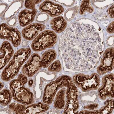 Immunohistochemistry-Paraffin: LRP-5 Antibody [NBP2-37868]