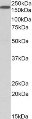 Western Blot: LRP-5 Antibody [NB100-1886]