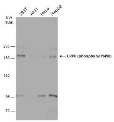 Western Blot: LRP-6 [p Ser1490] Antibody [NBP3-12921]