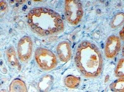 Immunohistochemistry-Paraffin: LRP-6 Antibody [NB100-1475]