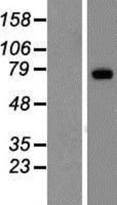 Western Blot: LRP10 Overexpression Lysate [NBP2-07385]