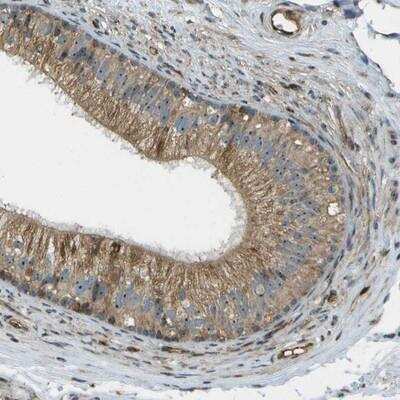 Immunohistochemistry-Paraffin: ST7/LRP12 Antibody [NBP1-83707]