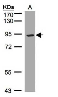 Western Blot: ST7/LRP12 Antibody [NBP1-30913]