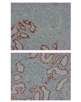 Immunohistochemistry-Paraffin: LRP2 Antibody (CD7D5) - Azide and BSA Free [NB110-96417]