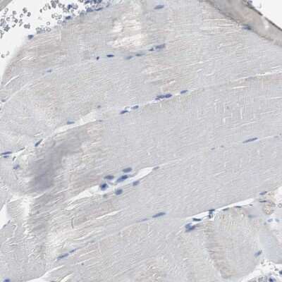 Immunohistochemistry-Paraffin: LRP2 Antibody [NBP1-85292]