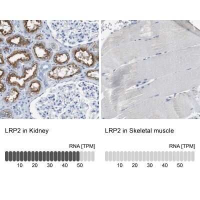 Immunohistochemistry-Paraffin: LRP2 Antibody [NBP1-85292]