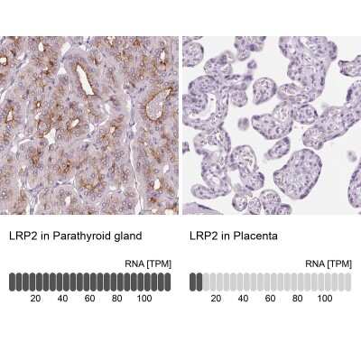 Immunohistochemistry-Paraffin: LRP2 Antibody [NBP2-39033]